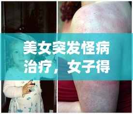 美女突发怪病治疗，女子得了怪病很多地方都治不好 