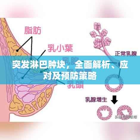 突发淋巴肿块,全面解析、应对及预防策略