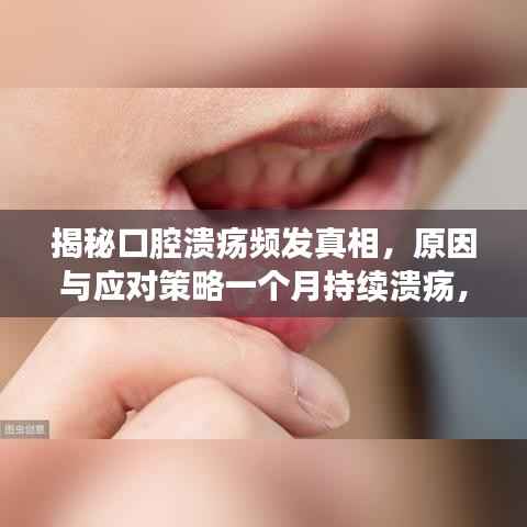 揭秘口腔溃疡频发真相,原因与应对策略一个月持续溃疡,如何应对?